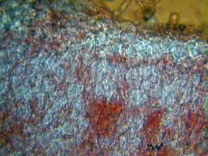 Hydnocystis piligera.